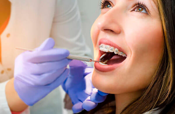 Quando procurar um ortodontista?